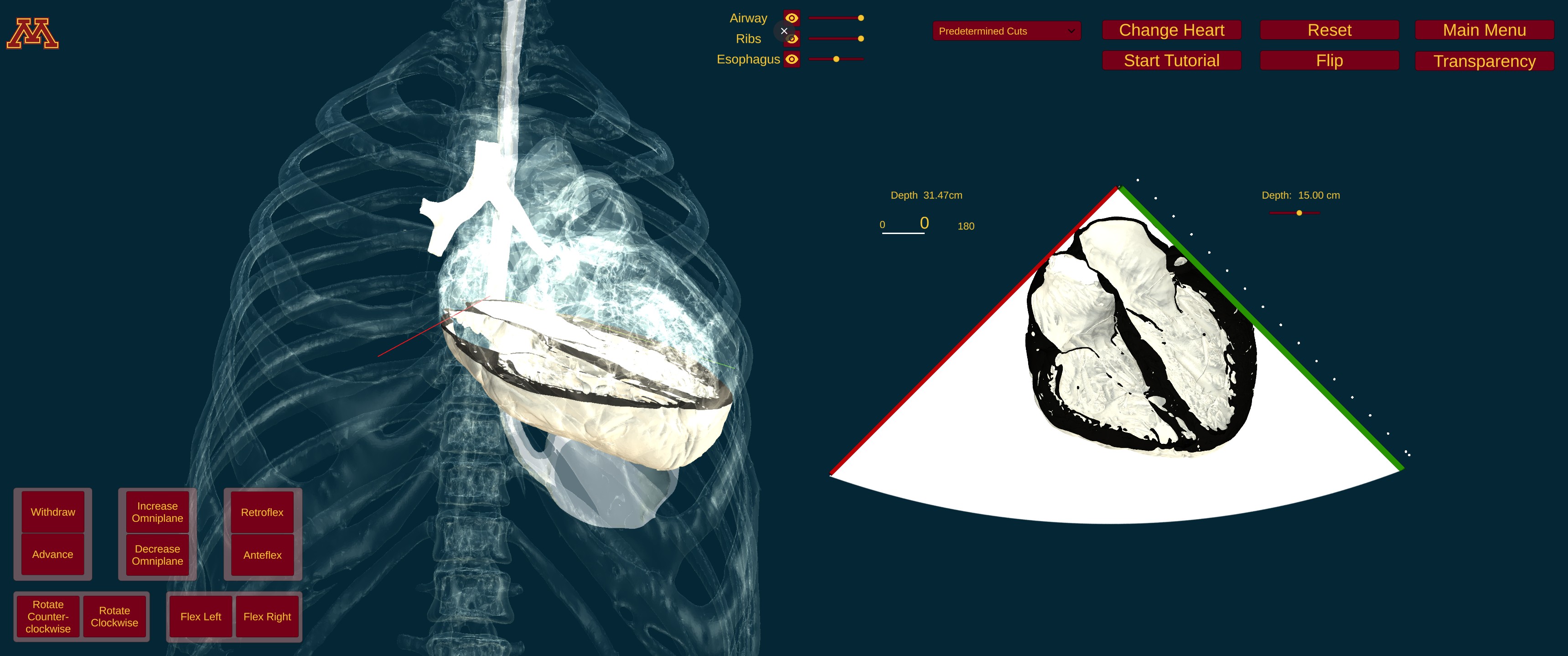 UMN TEE Simulator (WebGL)